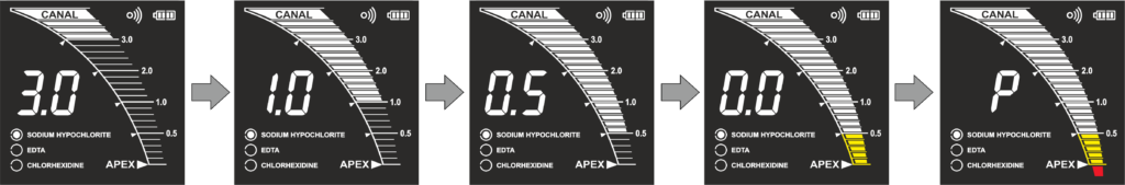 Апекслокатор EndoEst Apex 02