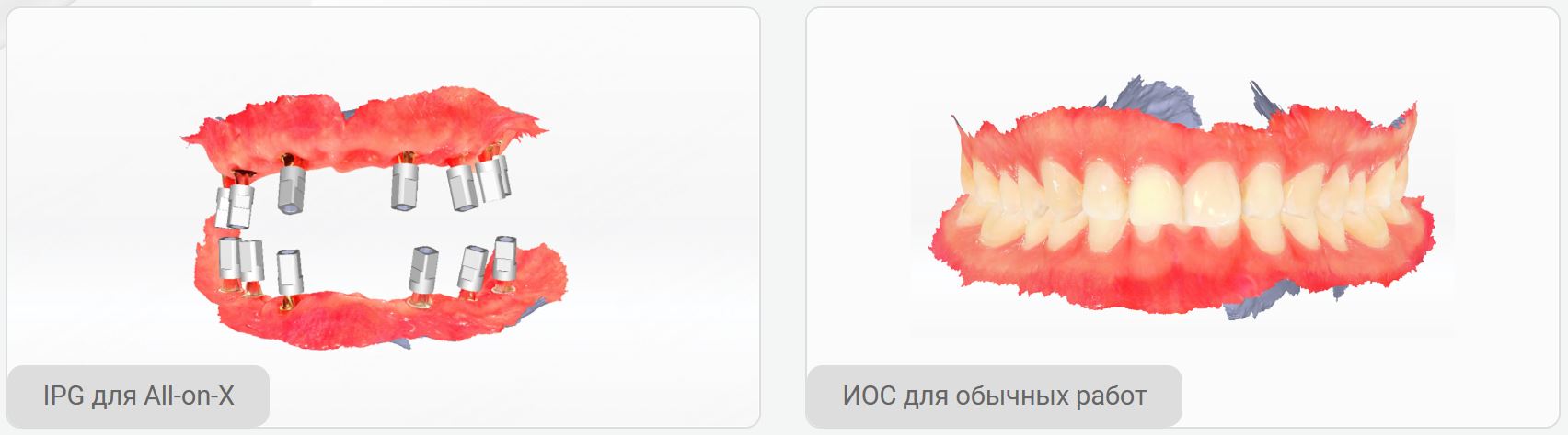 сканер Aoralscan Elite