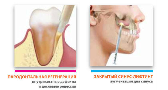 гель40 остеобиол