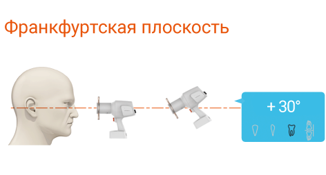 Рентгеновский аппарат EzRay Air Portable VEX-P300