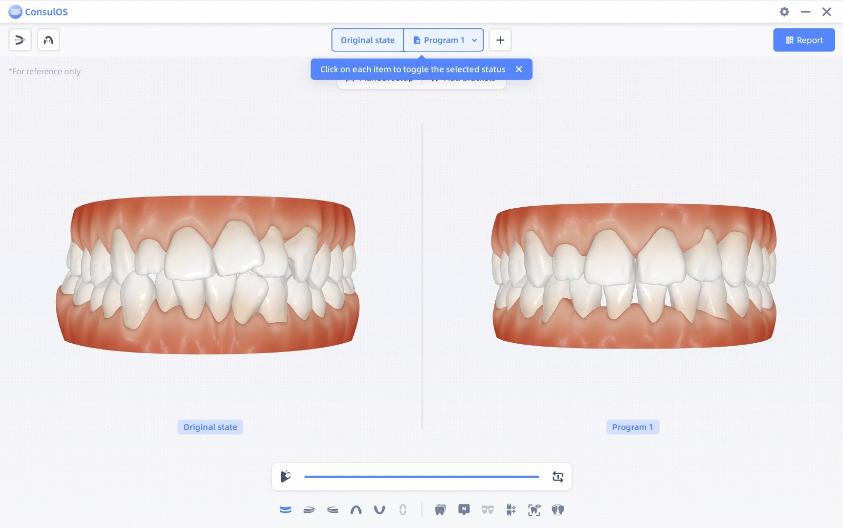 сканер Aoralscan 3