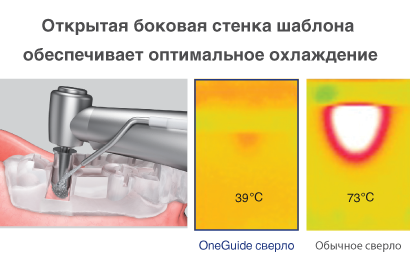 Набор навигационный One Guide Osstem