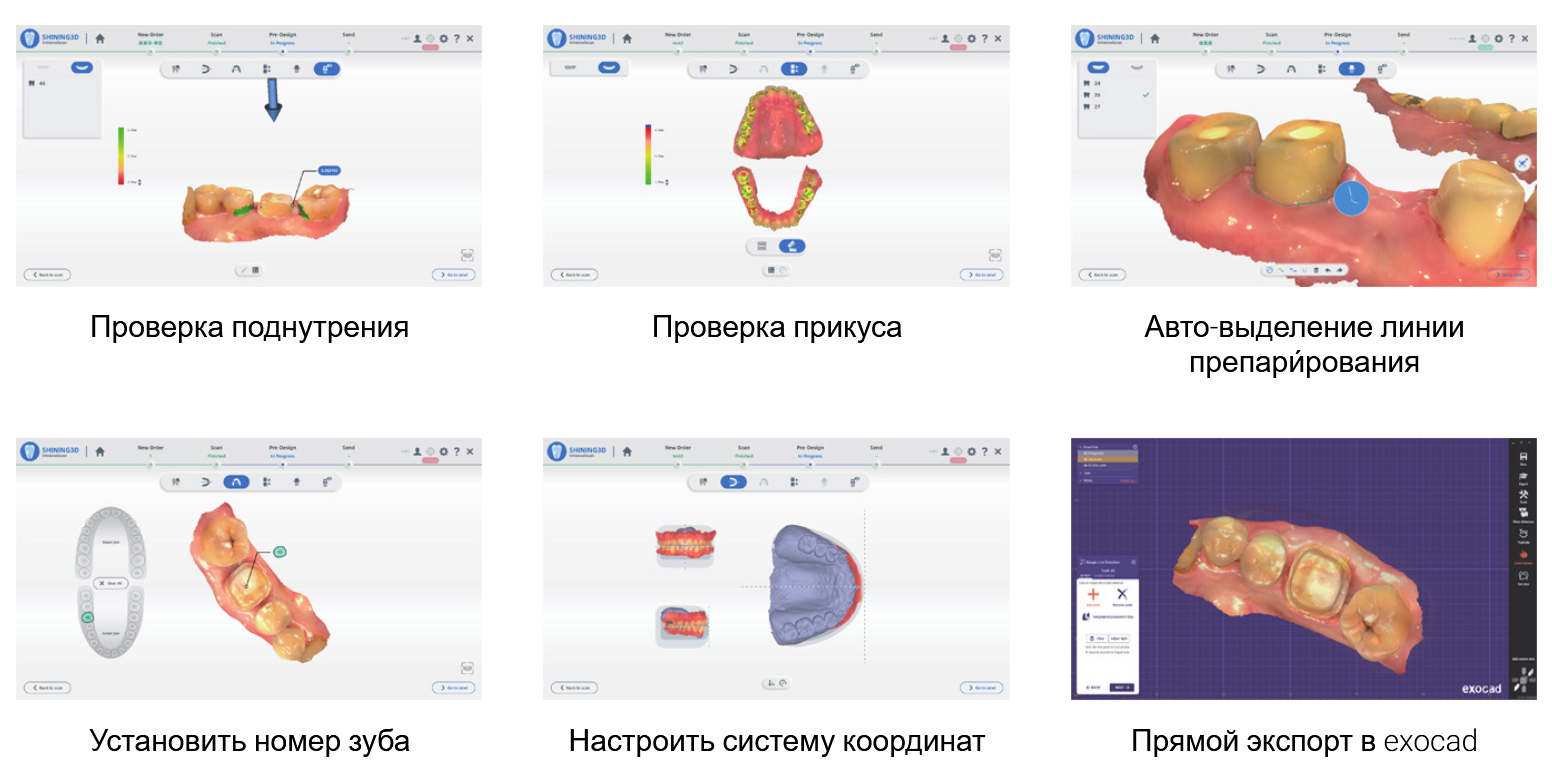 сканер Aoralscan 3