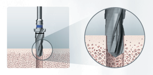 Набор Taper 122 Осстем