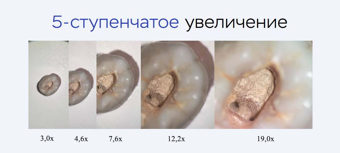 Микроскоп АМ-2000 Plus, ALLTION