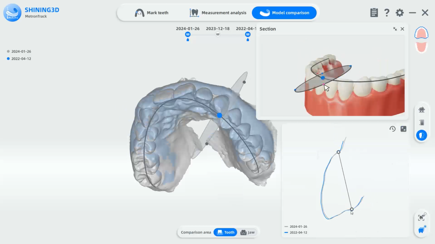 сканер Aoralscan 3