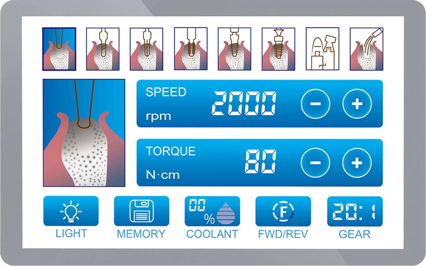 Физиодиспенсер Implant-X, DTE
