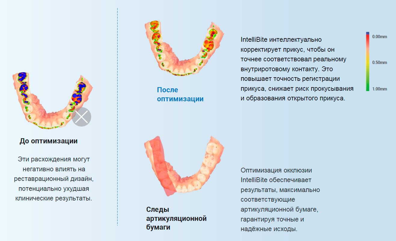 сканер Aoralscan Elf