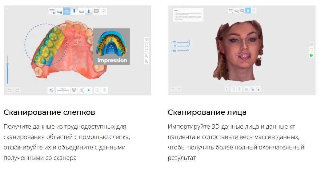 Сканер интраоральный i700 Medit
