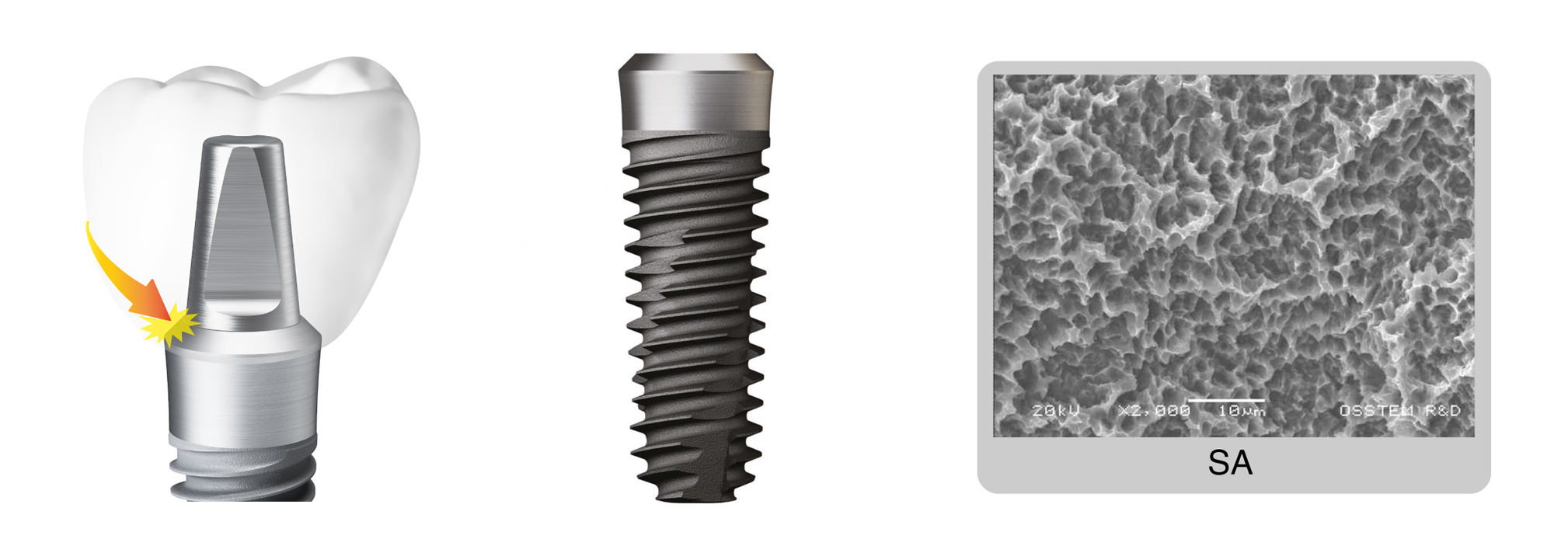 Имплантат Osstem SSIII Standart D-3,5мм