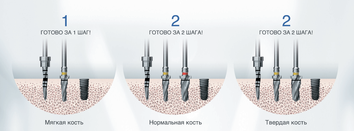 Набор Taper 122 Осстем