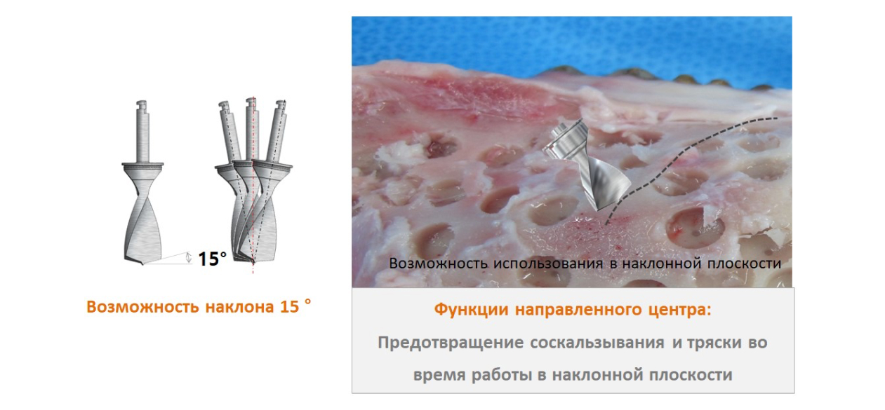 Сверло для забора аутокости Osstem