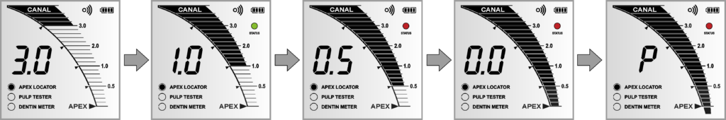 Апекслокатор EndoEst-3D Геософт