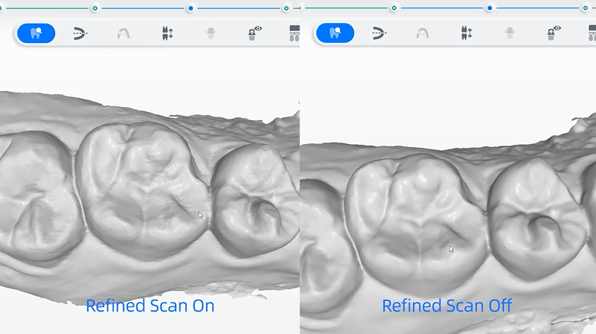 сканер Aoralscan 3