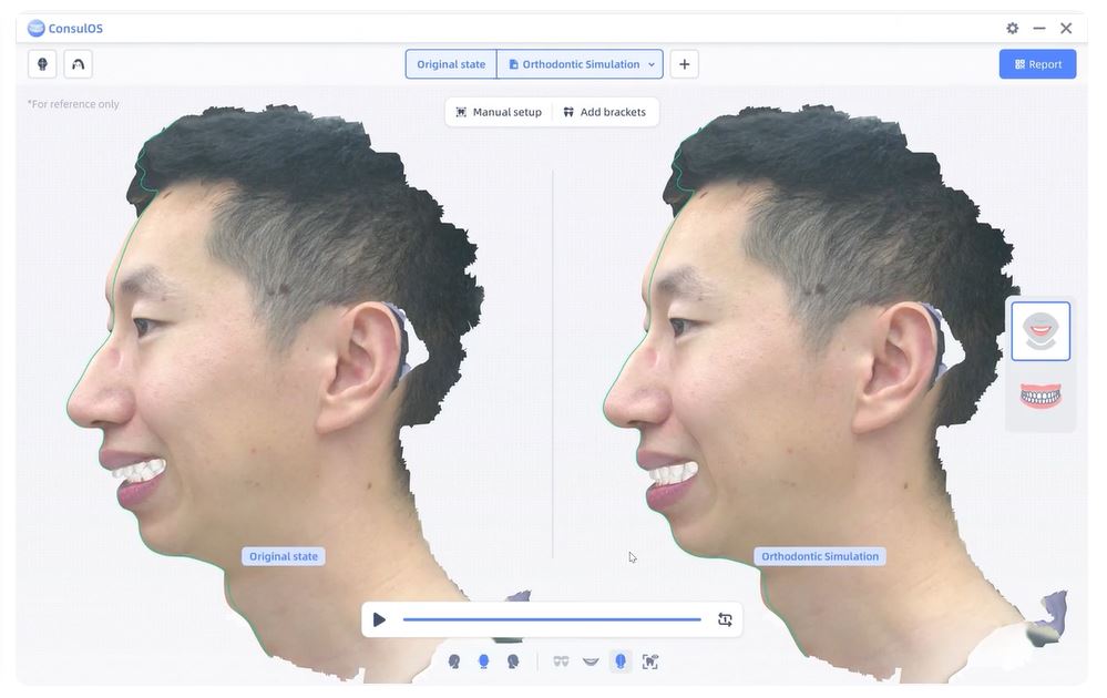 Сканер лица MetiSmileMR