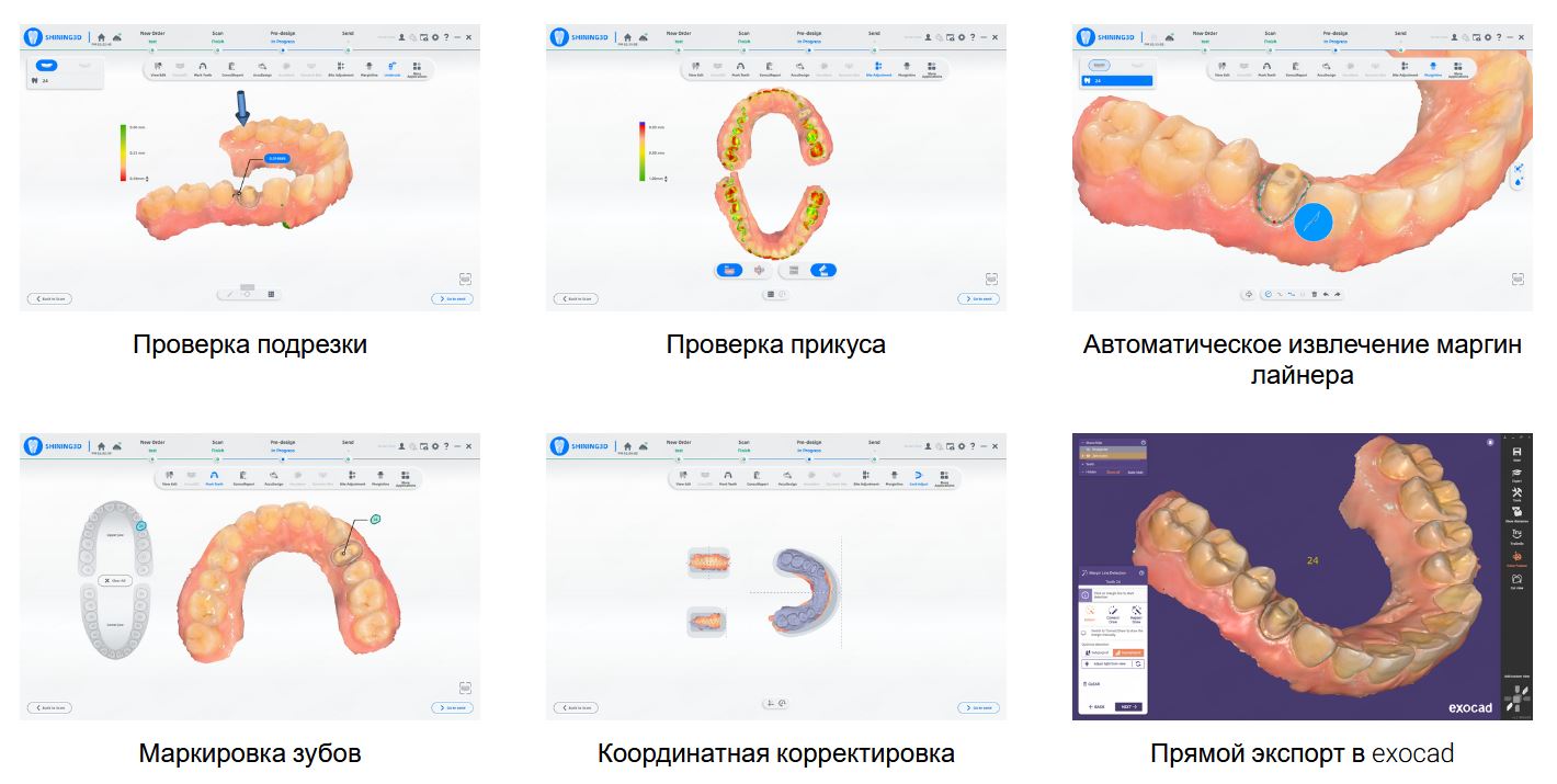 сканер Aoralscan Lync
