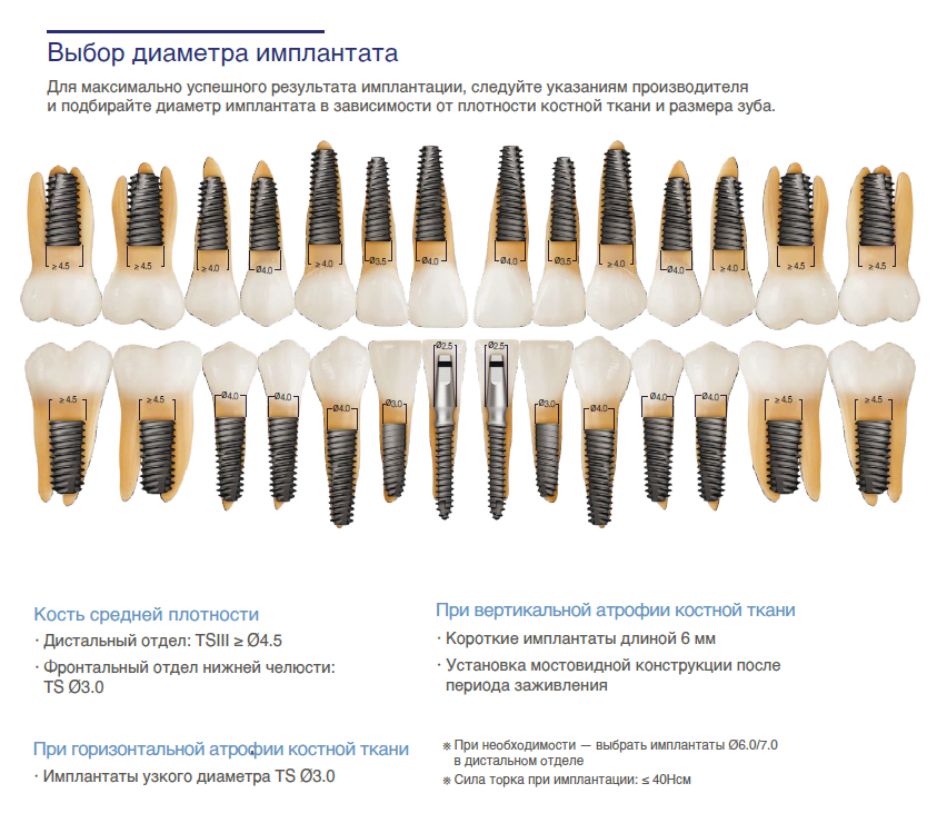 Имплантат Osstem SSIII Standart D-3,5мм