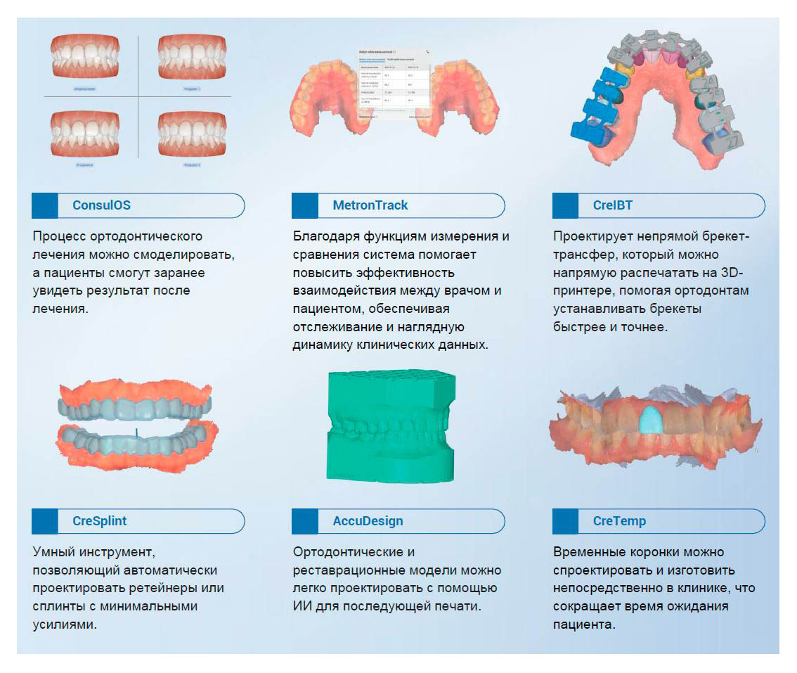 сканер Aoralscan Elf