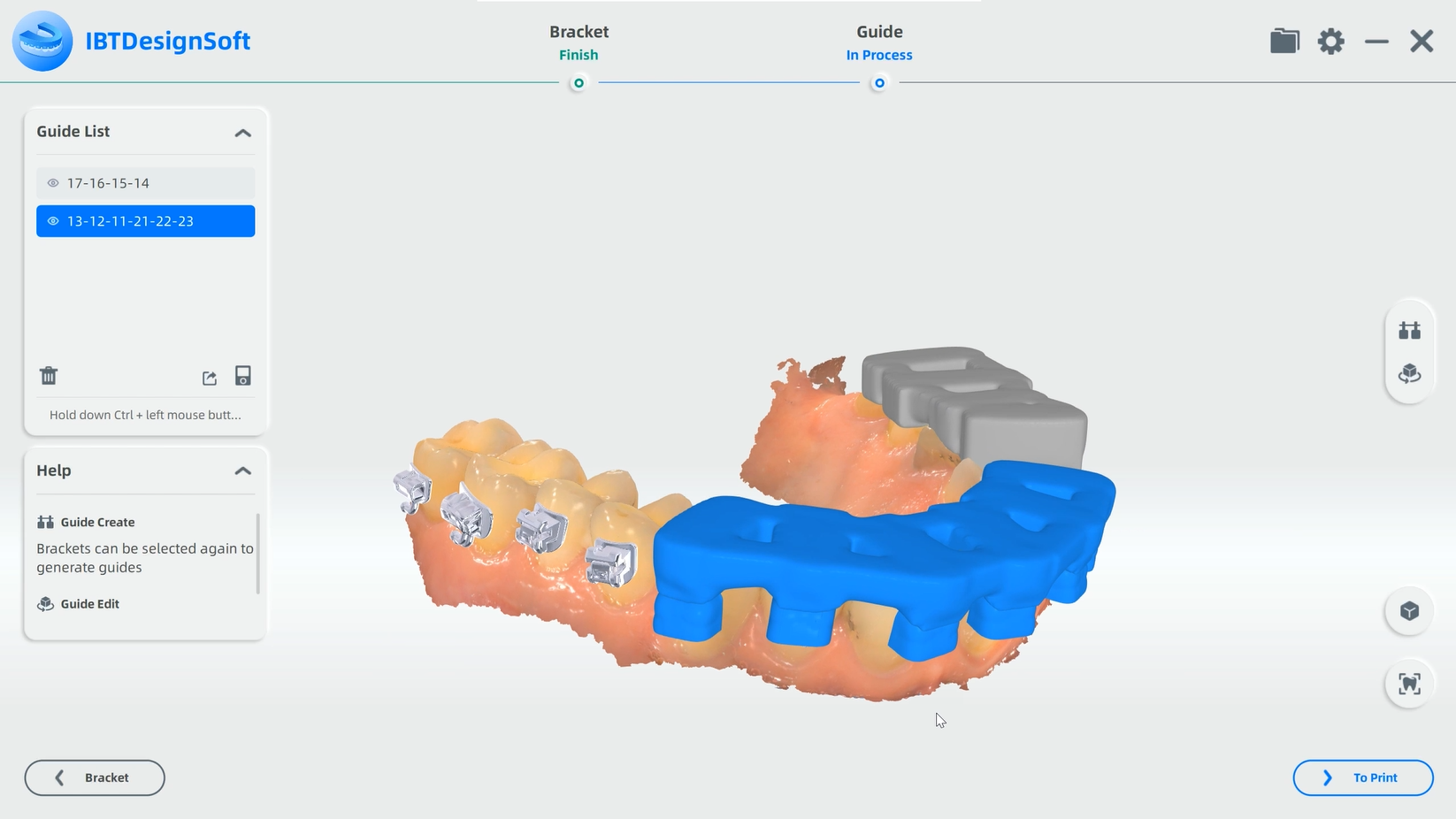 сканер Aoralscan 3