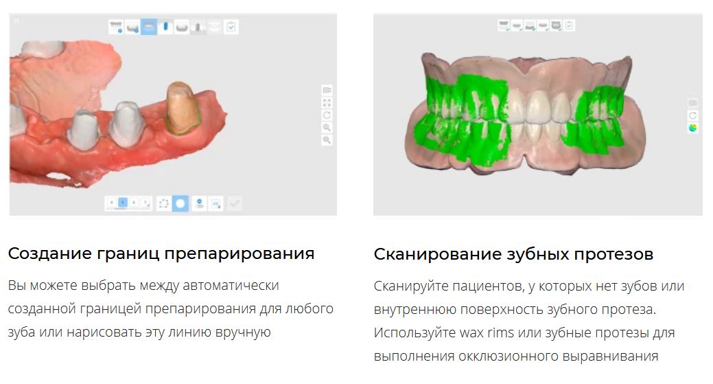 Сканер интраоральный i700 Medit