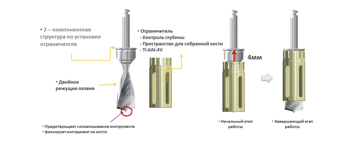 Сверло для забора аутокости Osstem