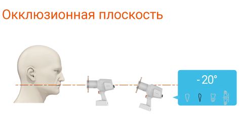 Рентгеновский аппарат EzRay Air Portable VEX-P300