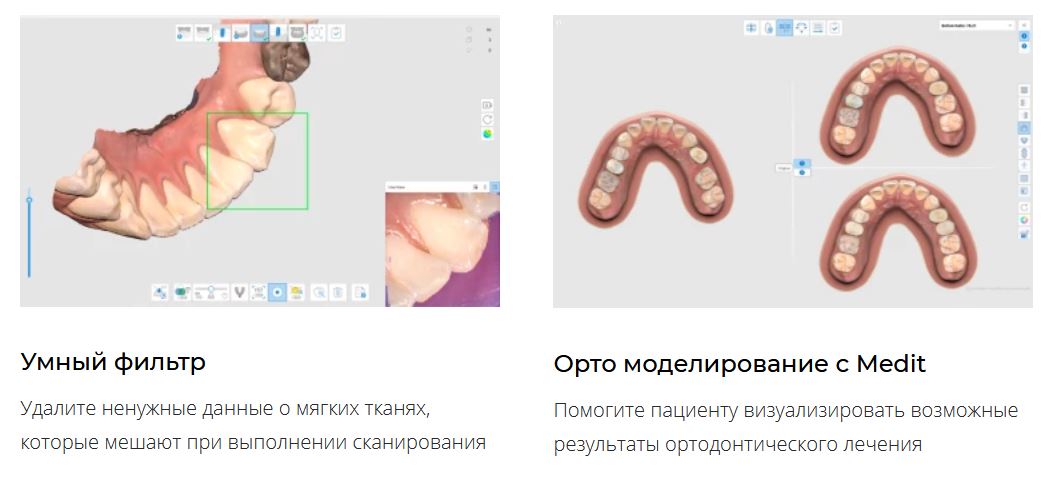 Сканер интраоральный i700 Medit