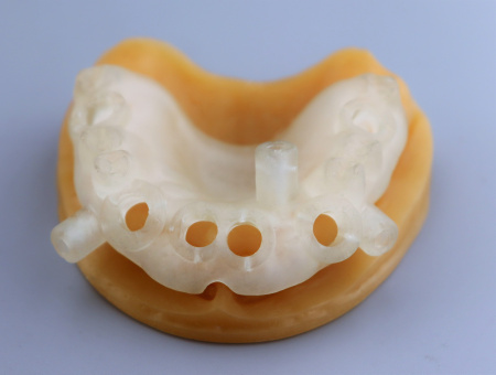 Смола фотополимерная Dental Surgical LCD/DLP 1кг, Gorky Liquid