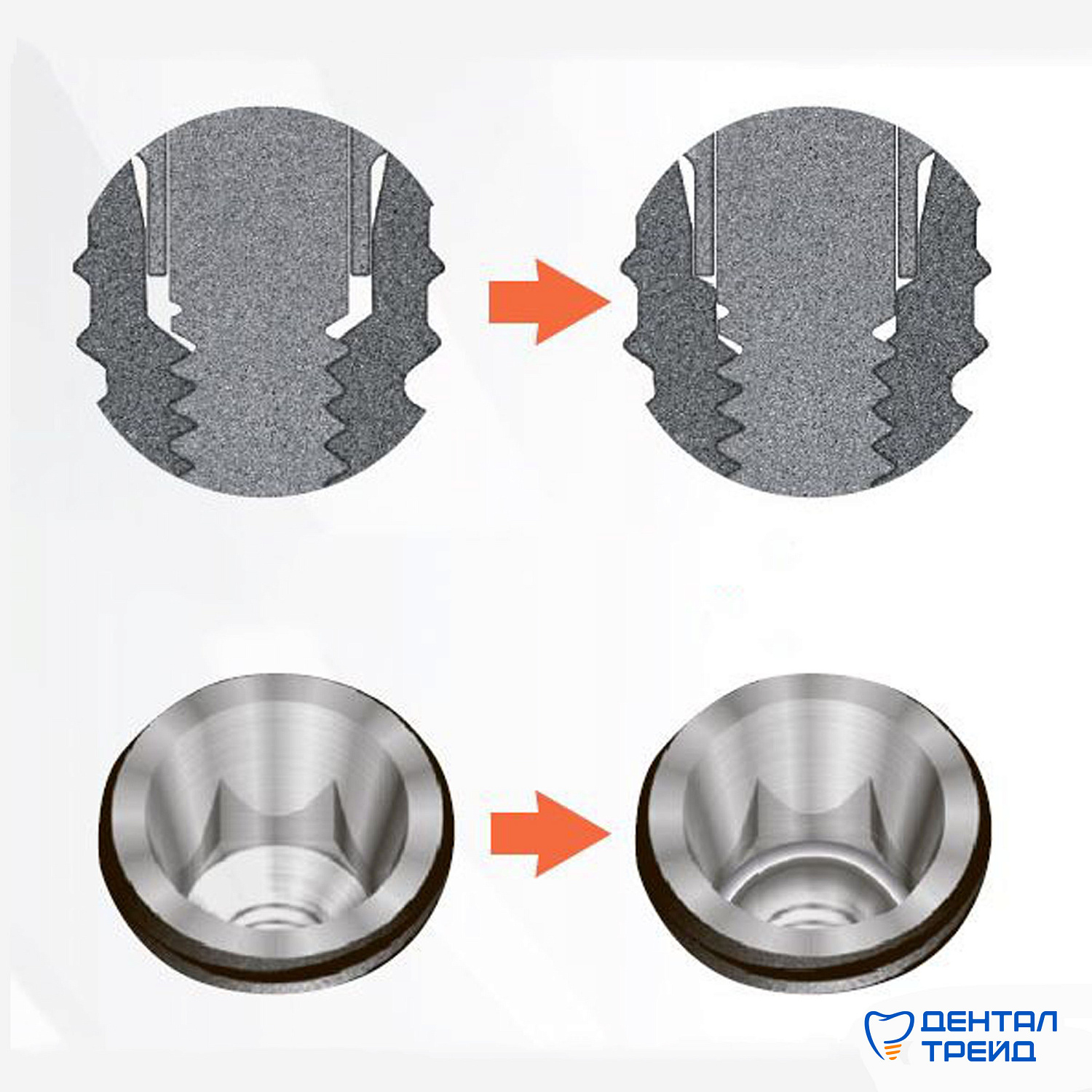 Новая конструкция имплантатов TS Osstem
