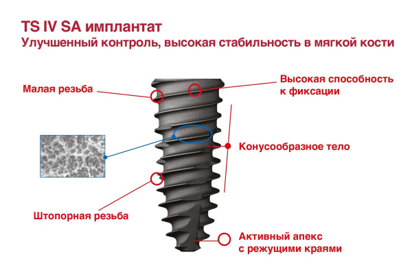 Имплантат Osstem TSIV Regular, D-4,0 мм