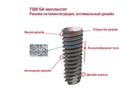 Имплантат Osstem TSIII Regular, D-4,5 мм