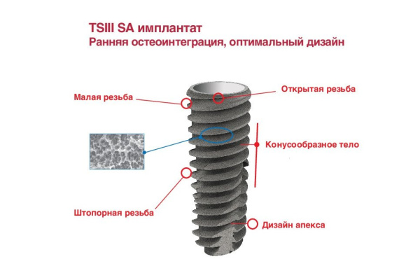 Имплантат Osstem TSIII Mini, D-3,0 мм